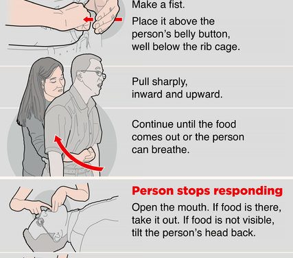 Dr. Heimlich Employs His Maneuver